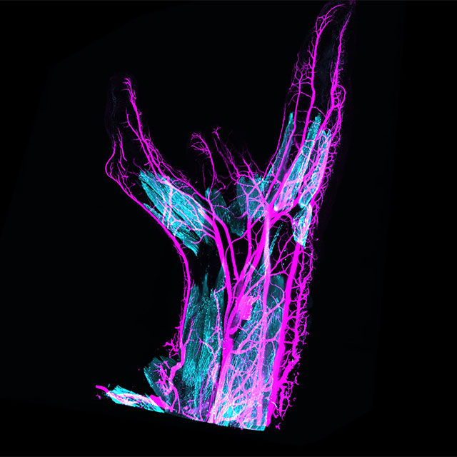 Lightsheet fluorescence microscopy
