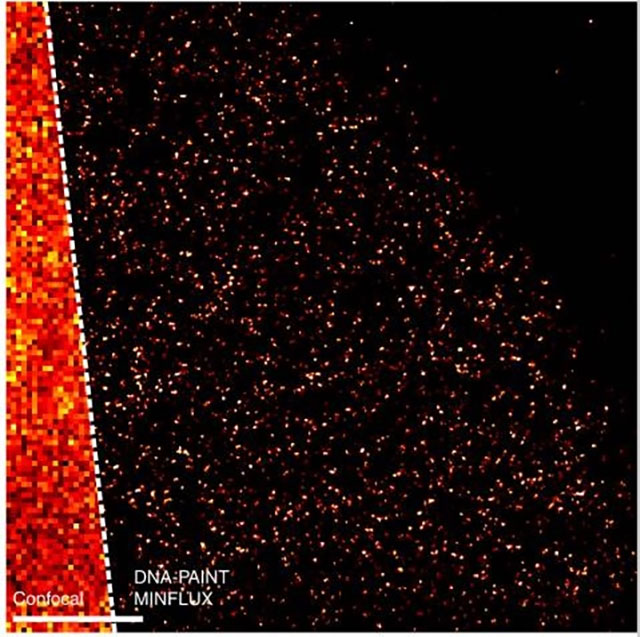 Confocal versus super-resolution microscopy